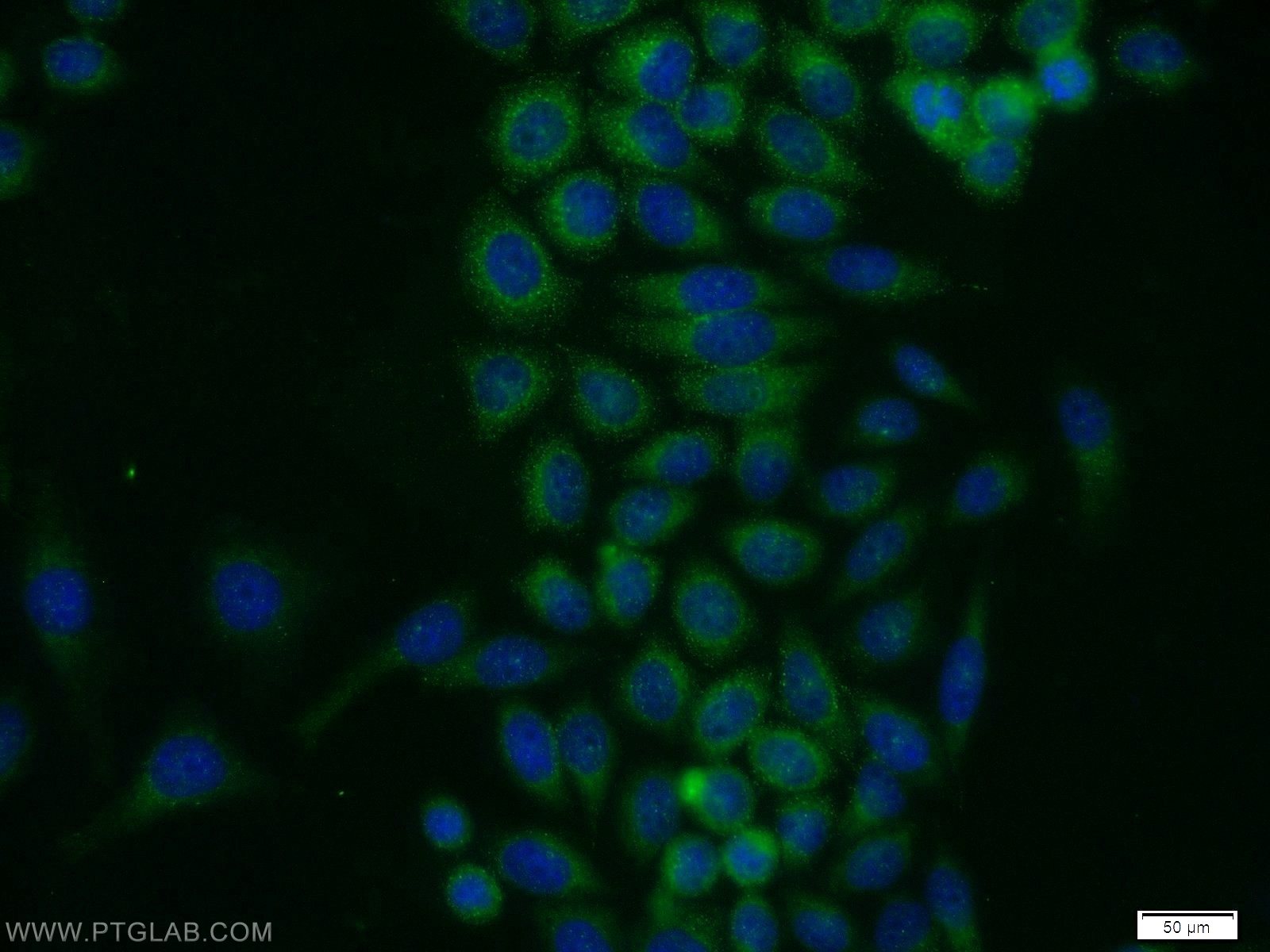 Immunofluorescence (IF) / fluorescent staining of MCF-7 cells using PRKAR2A Polyclonal antibody (10142-2-AP)