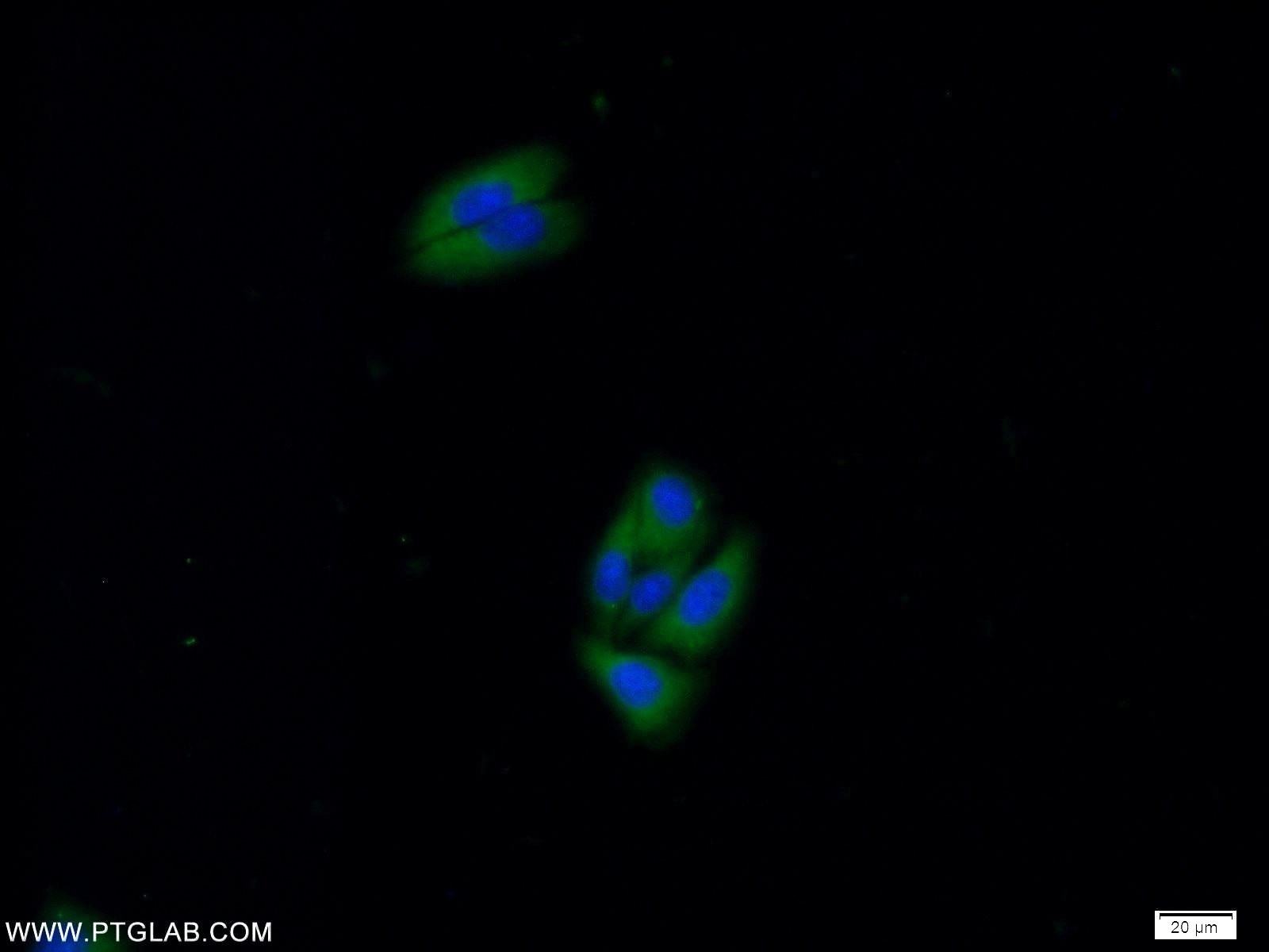 Immunofluorescence (IF) / fluorescent staining of HepG2 cells using PRKAR2A Polyclonal antibody (10142-2-AP)