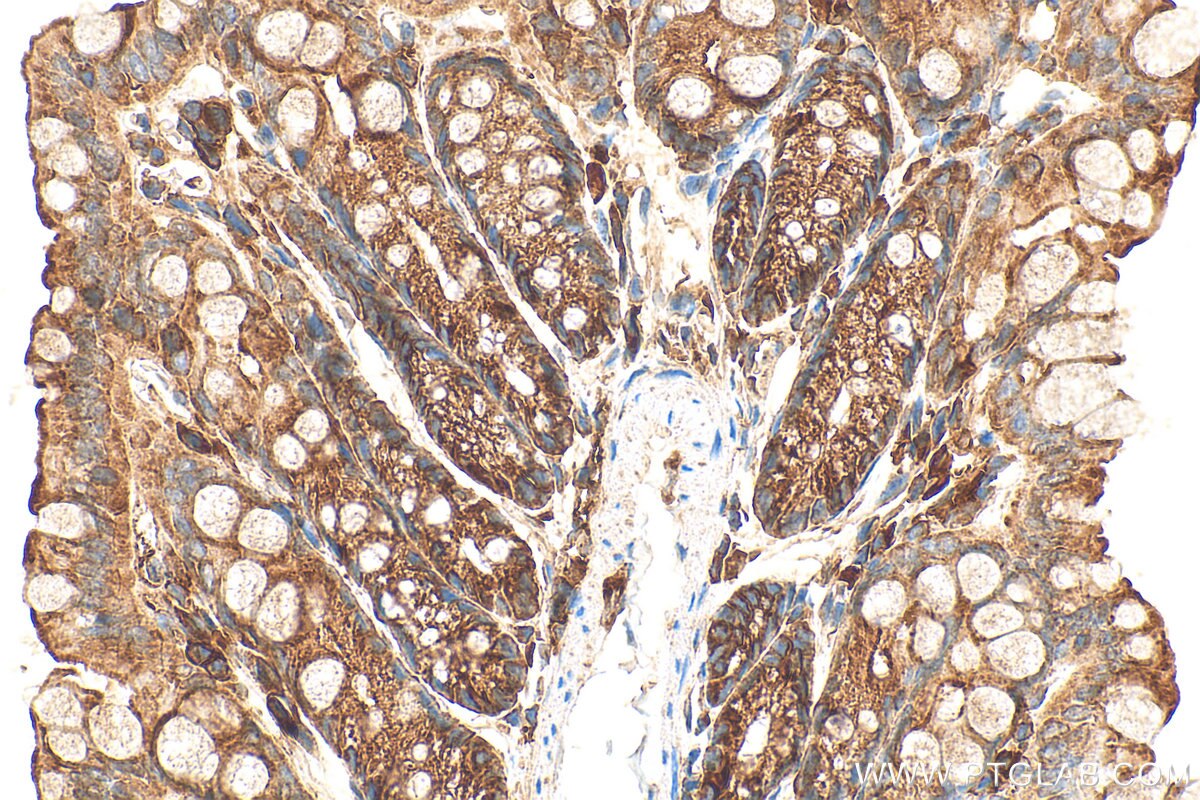 Immunohistochemistry (IHC) staining of mouse colon tissue using PRKAR2A Polyclonal antibody (10142-2-AP)