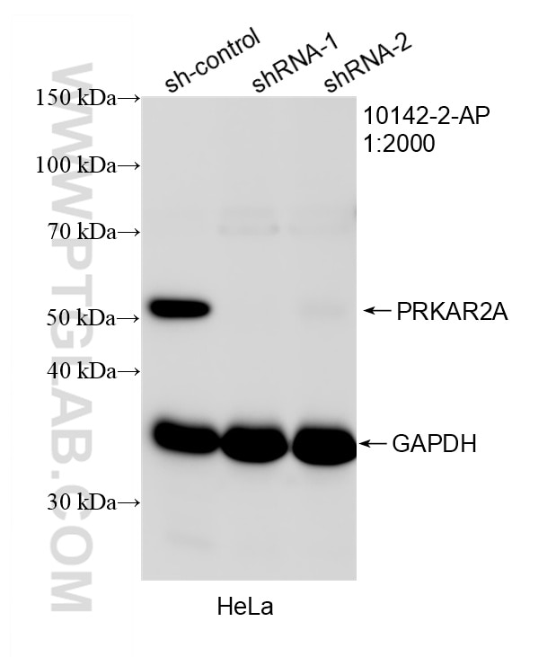 Western Blot (WB) analysis of HeLa cells using PRKAR2A Polyclonal antibody (10142-2-AP)