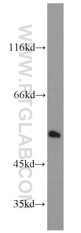 Western Blot (WB) analysis of MCF-7 cells using PRKAR2A Polyclonal antibody (10142-2-AP)
