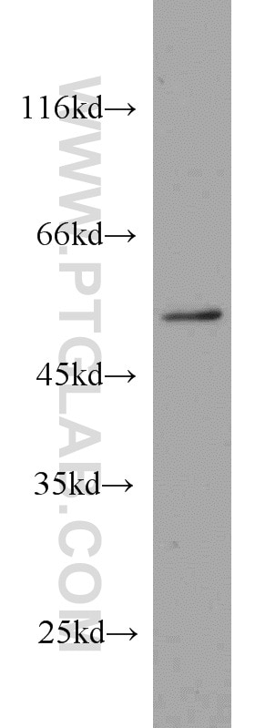Western Blot (WB) analysis of HeLa cells using PRKAR2A Polyclonal antibody (10142-2-AP)