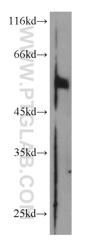 Western Blot (WB) analysis of mouse testis tissue using PRKAR2A Polyclonal antibody (10142-2-AP)