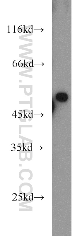 Western Blot (WB) analysis of PC-3 cells using PRKAR2A Polyclonal antibody (10142-2-AP)