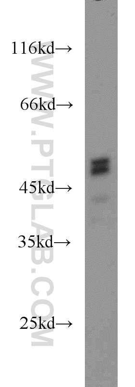 Western Blot (WB) analysis of human testis tissue using PRKAR2A Polyclonal antibody (10142-2-AP)