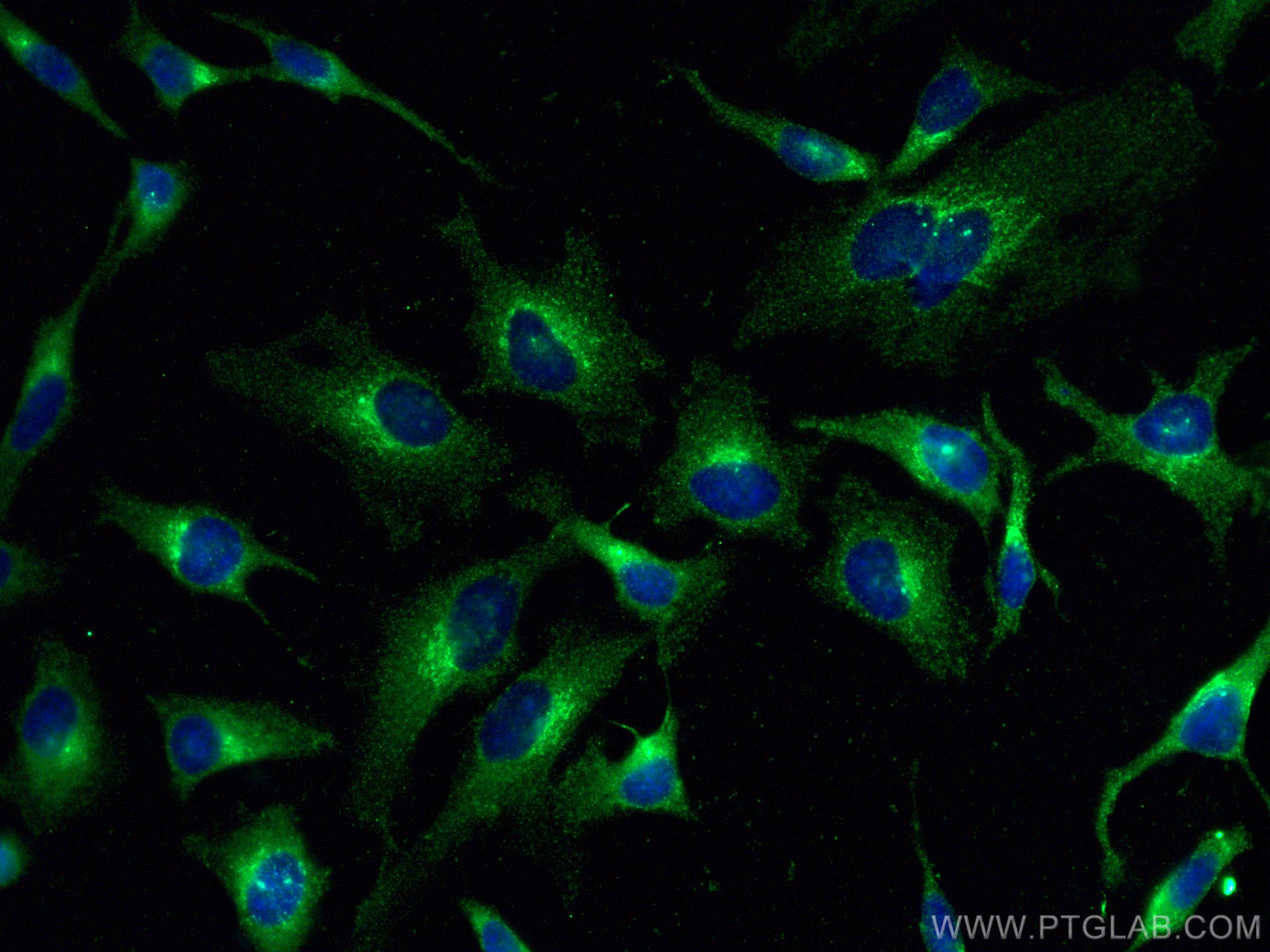 Immunofluorescence (IF) / fluorescent staining of HeLa cells using PRKAR2A Monoclonal antibody (67751-1-Ig)