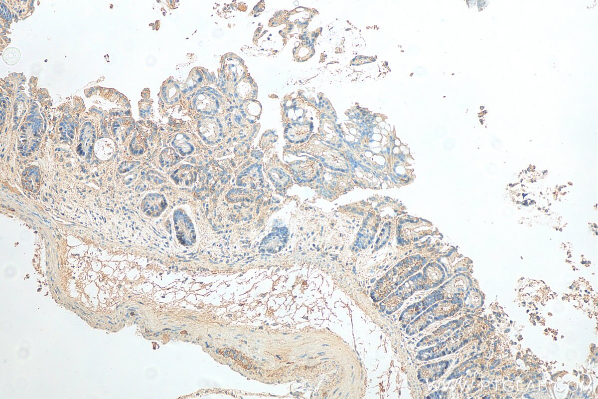 Immunohistochemistry (IHC) staining of mouse colon tissue using PRKAR2A Monoclonal antibody (67751-1-Ig)
