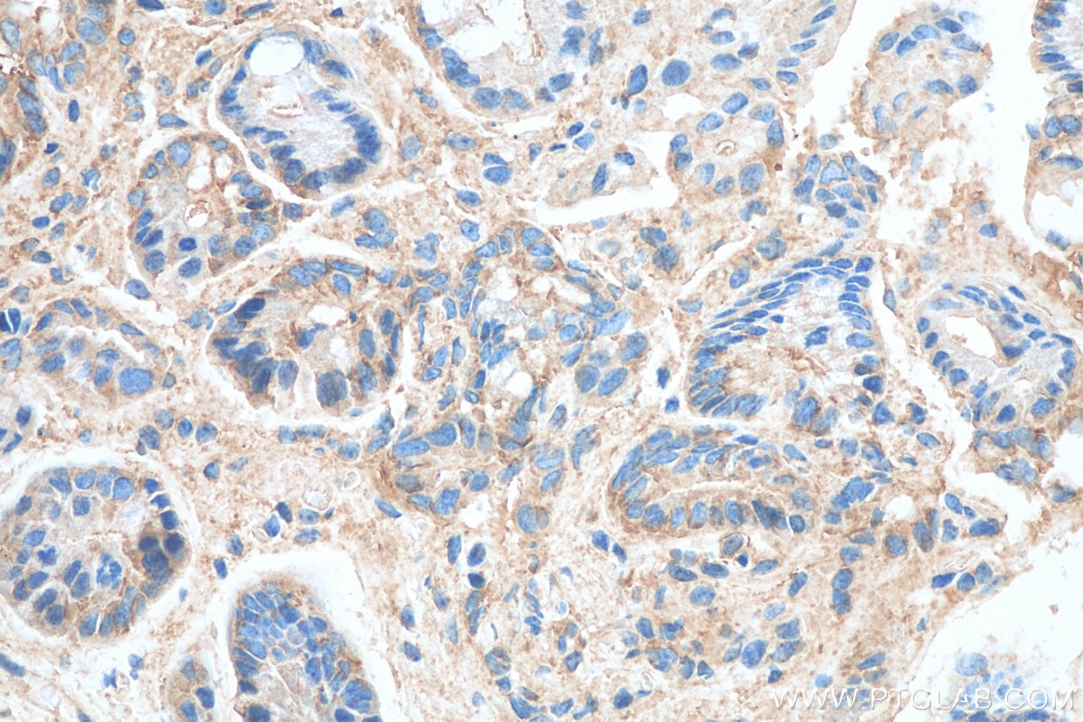 Immunohistochemistry (IHC) staining of mouse colon tissue using PRKAR2A Monoclonal antibody (67751-1-Ig)