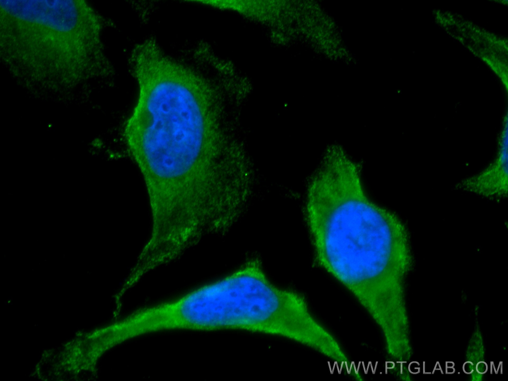 Immunofluorescence (IF) / fluorescent staining of HeLa cells using CoraLite® Plus 488-conjugated PRKAR2A Monoclonal a (CL488-67751)