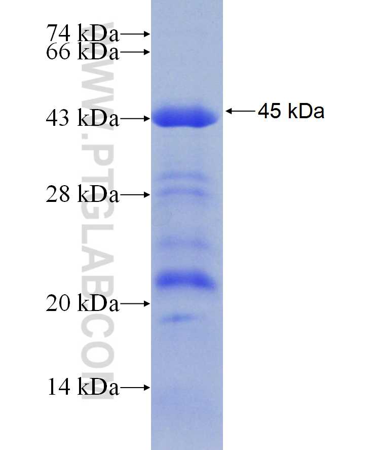 PRKAR2A fusion protein Ag29893 SDS-PAGE