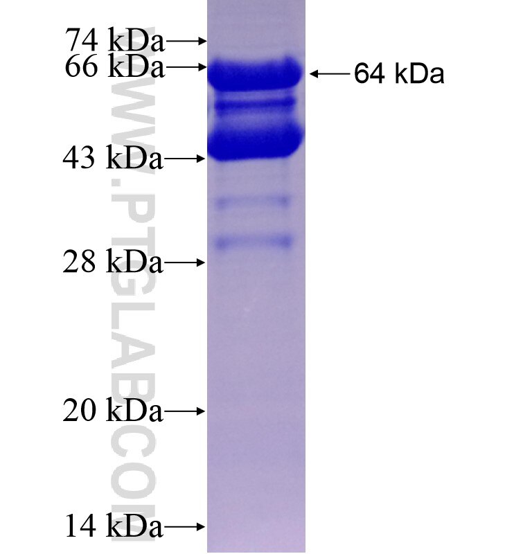 PRKAR2A fusion protein Ag0203 SDS-PAGE