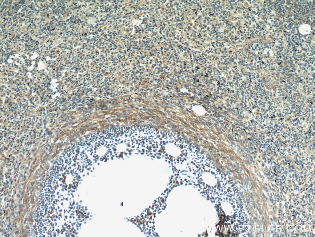 Immunohistochemistry (IHC) staining of human ovary tissue using PRKAR2B Polyclonal antibody (20845-1-AP)