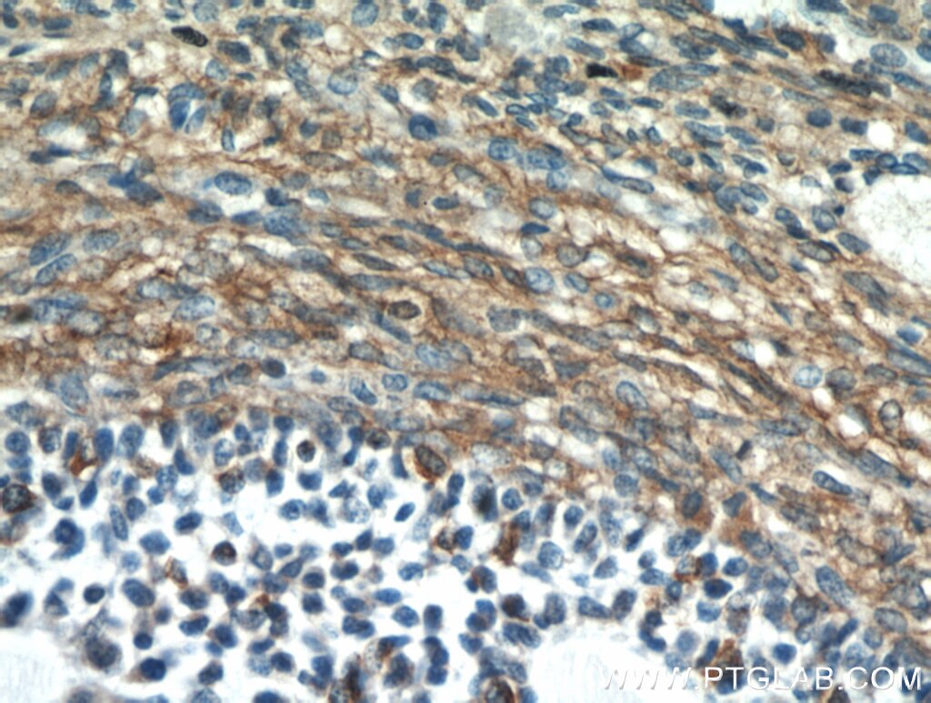 Immunohistochemistry (IHC) staining of human ovary tissue using PRKAR2B Polyclonal antibody (20845-1-AP)