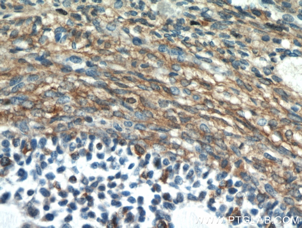 IHC staining of human ovary using 20845-1-AP