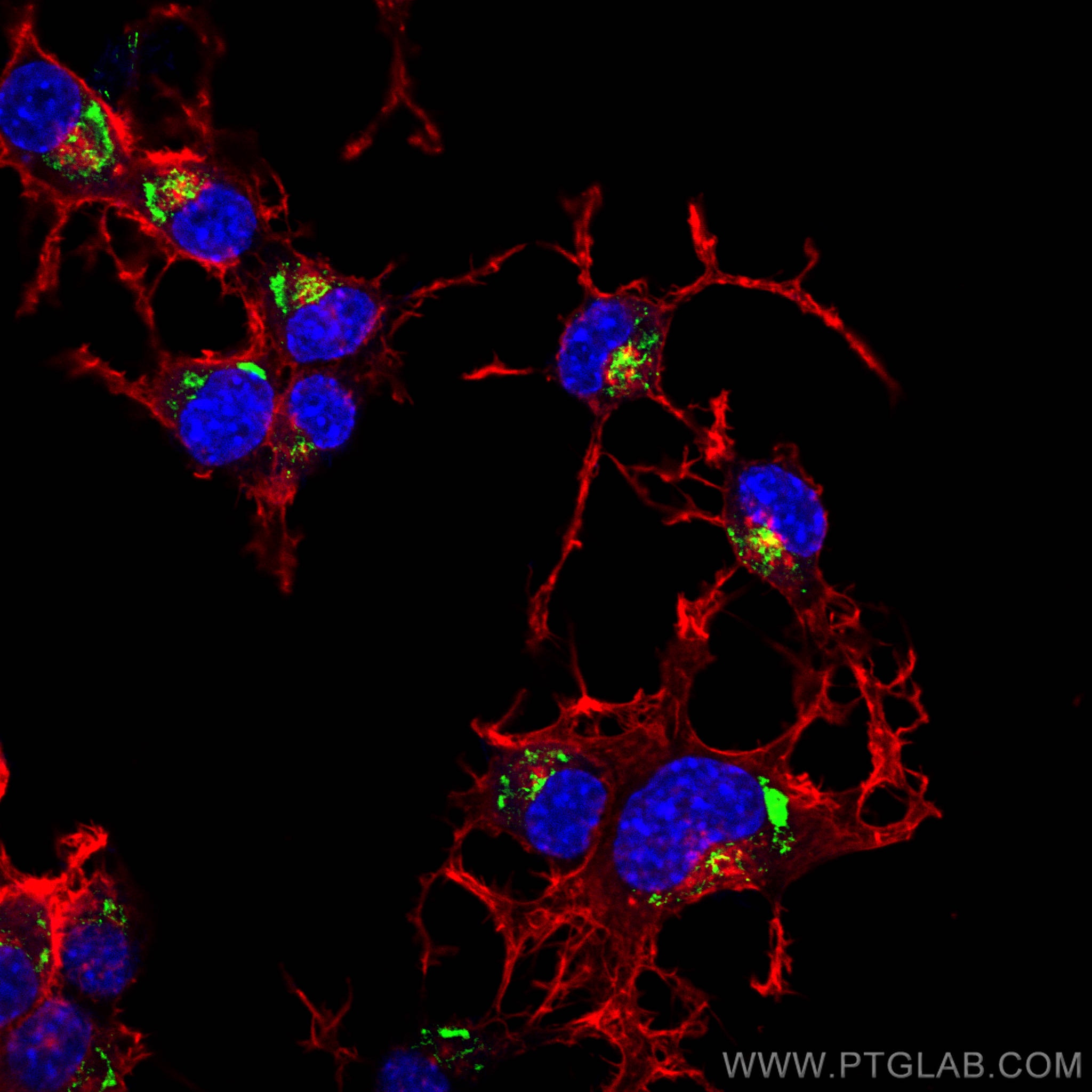 IF Staining of Neuro-2a using 28351-1-AP