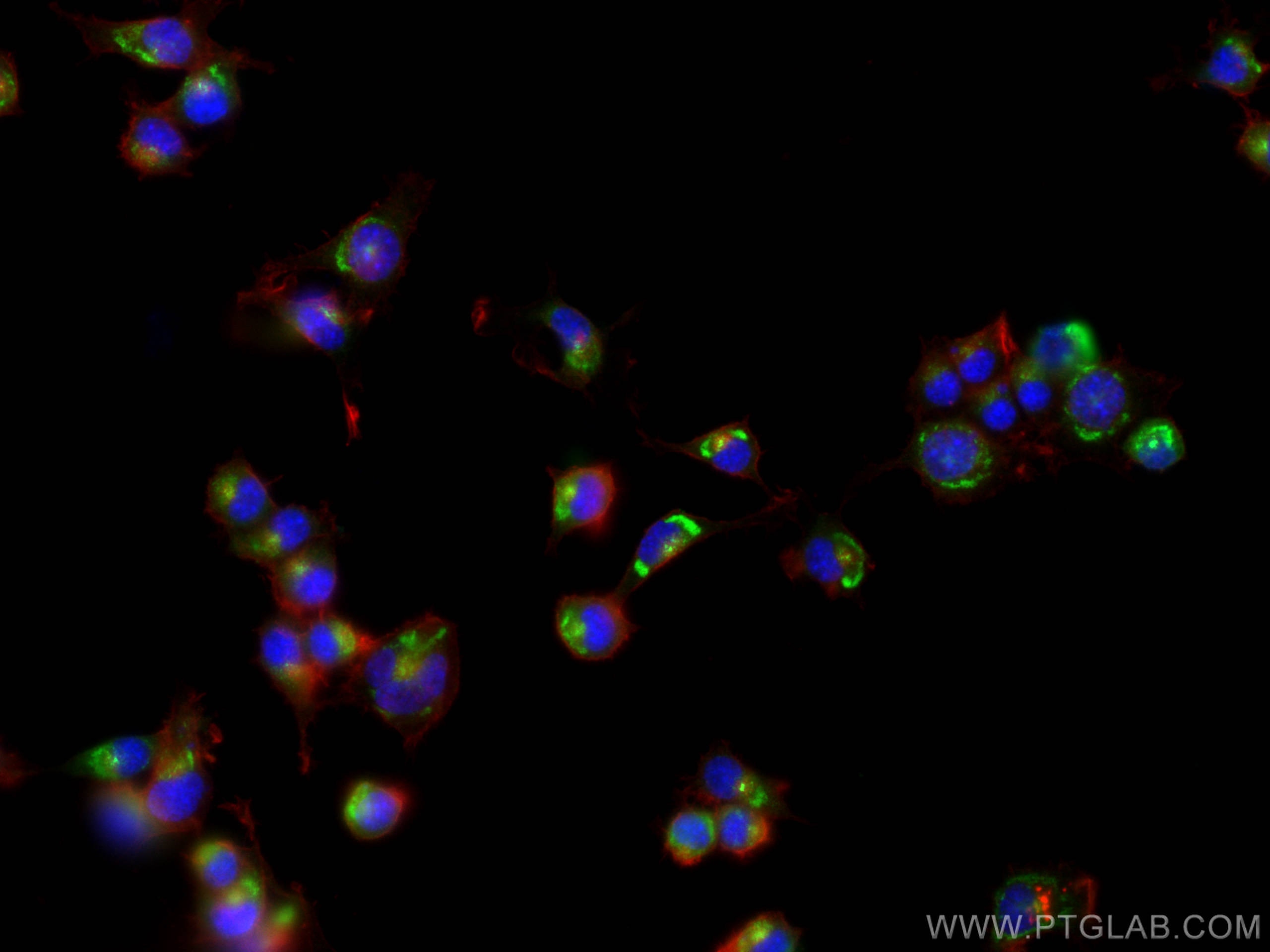 Immunofluorescence (IF) / fluorescent staining of Neuro-2a cells using PRKAR2B Polyclonal antibody (28351-1-AP)