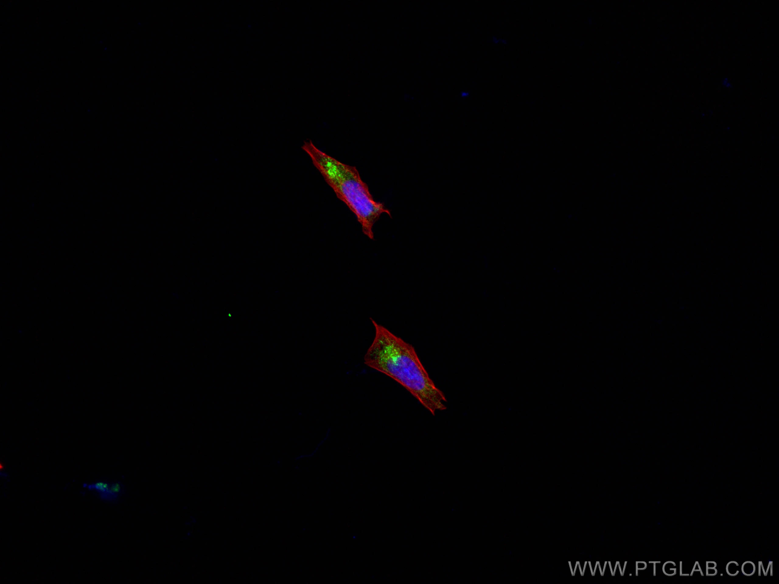 Immunofluorescence (IF) / fluorescent staining of SH-SY5Y cells using PRKAR2B Polyclonal antibody (28351-1-AP)