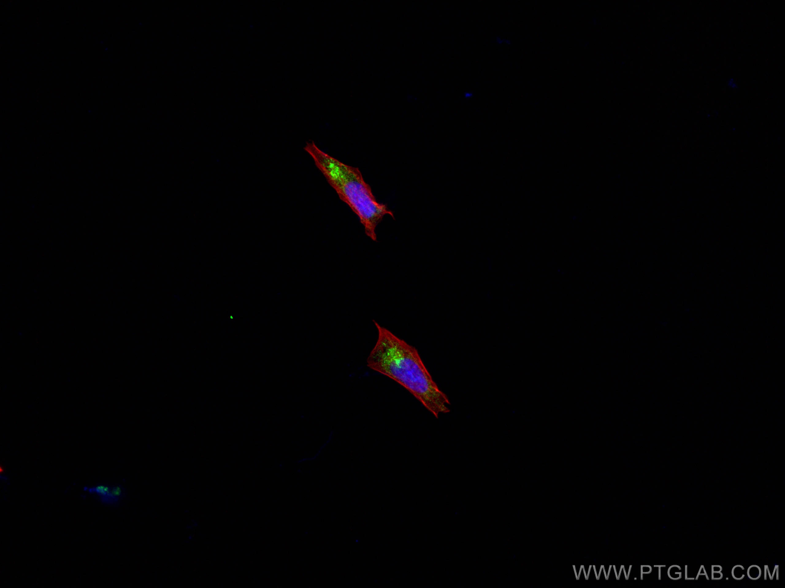 IF Staining of SH-SY5Y using 28351-1-AP