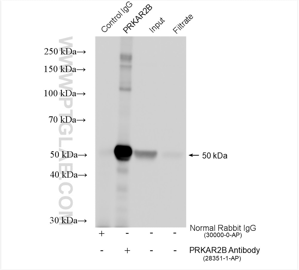Immunoprecipitation (IP) experiment of mouse brain tissue using PRKAR2B Polyclonal antibody (28351-1-AP)