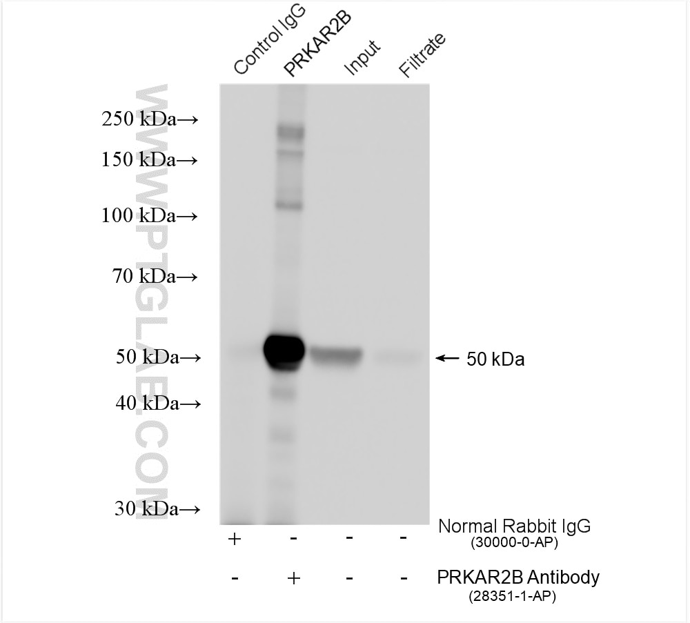 IP experiment of mouse brain using 28351-1-AP