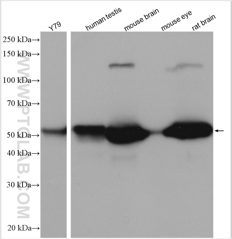 Western Blot (WB) analysis of various lysates using PRKAR2B Polyclonal antibody (28351-1-AP)