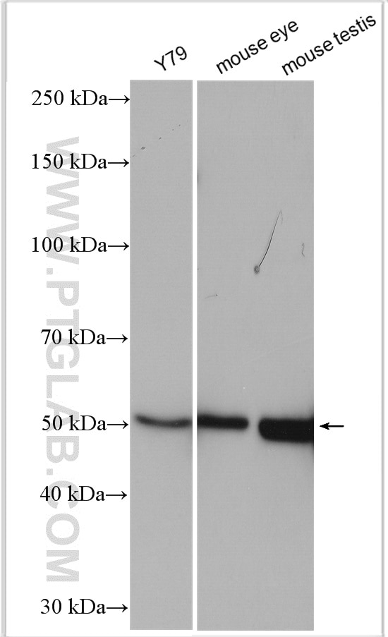 Western Blot (WB) analysis of various lysates using PRKAR2B Polyclonal antibody (28351-1-AP)