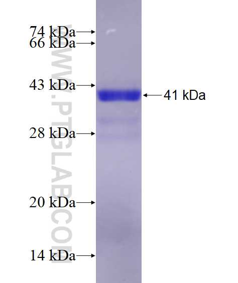 PRKAR2B fusion protein Ag28787 SDS-PAGE