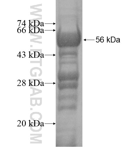 PRKAR2B fusion protein Ag11866 SDS-PAGE