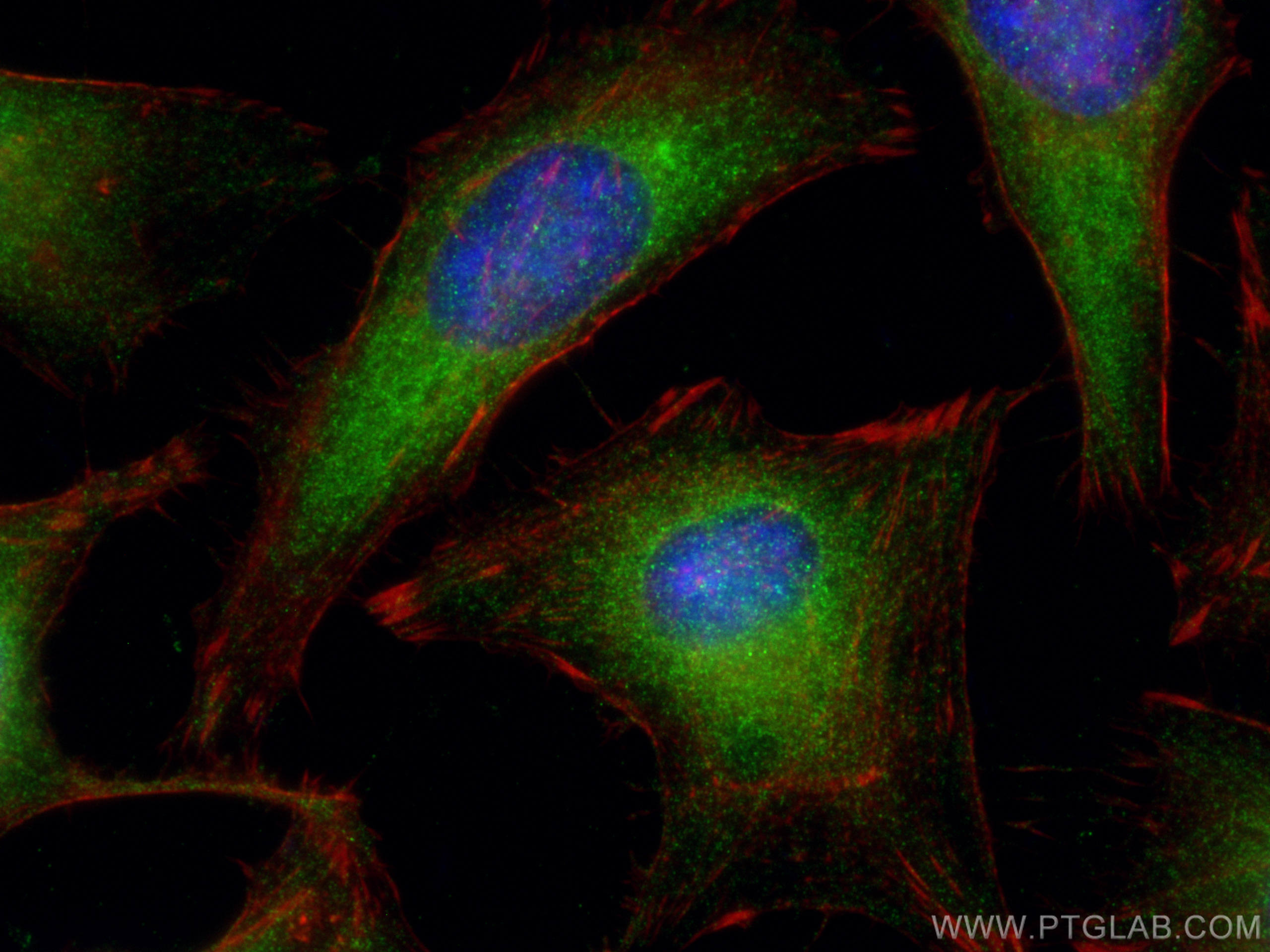 Immunofluorescence (IF) / fluorescent staining of HeLa cells using PKC Alpha Polyclonal antibody (21991-1-AP)
