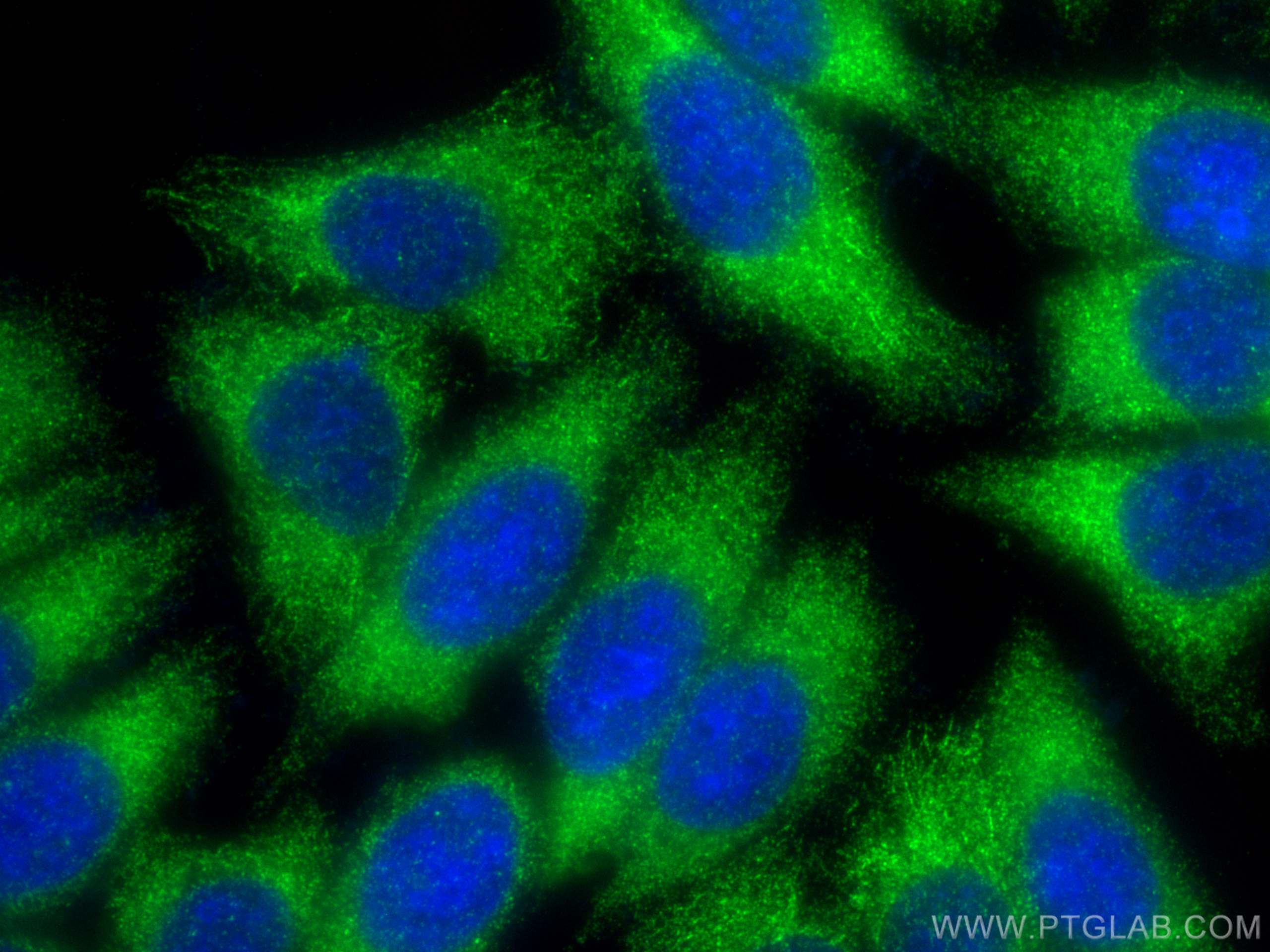 IF Staining of HepG2 using 21991-1-AP