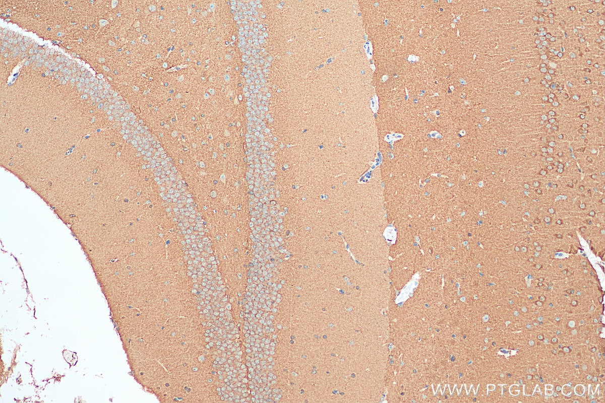 Immunohistochemistry (IHC) staining of mouse brain tissue using PKC Alpha Polyclonal antibody (21991-1-AP)