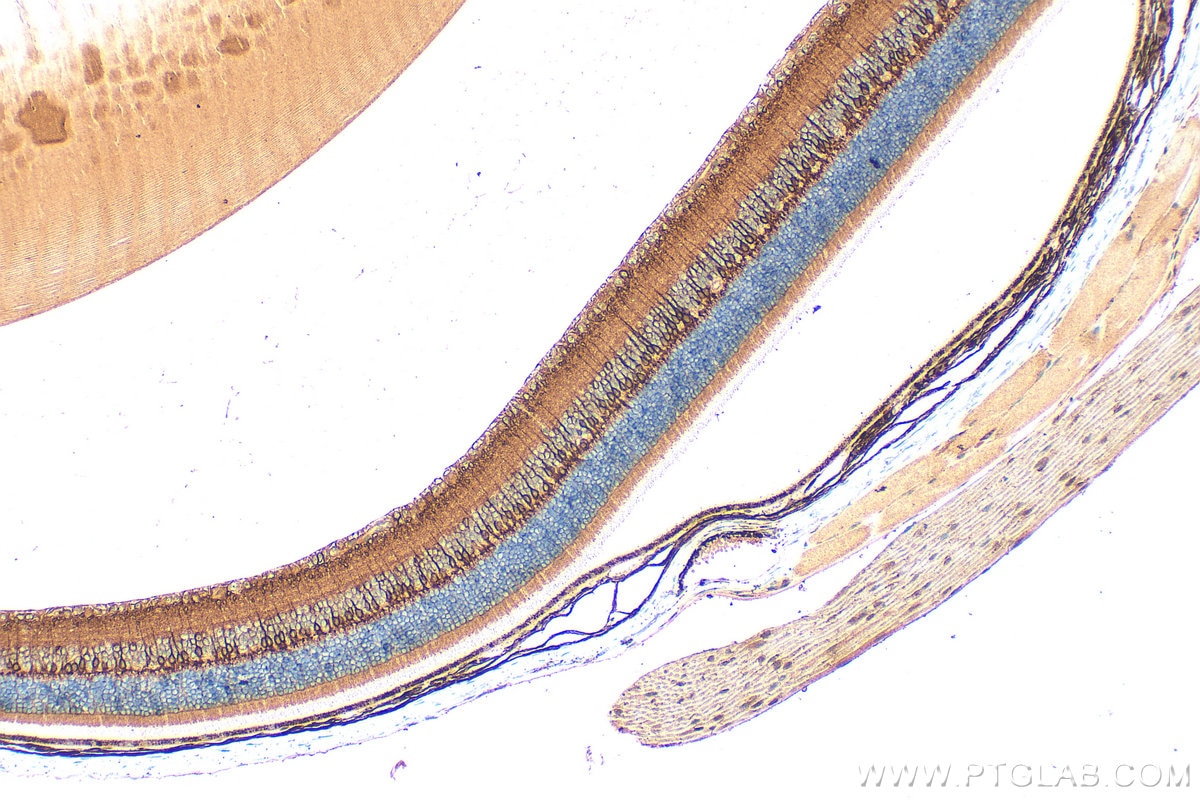 Immunohistochemistry (IHC) staining of mouse eye tissue using PKC Alpha Polyclonal antibody (21991-1-AP)