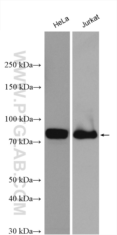 Western Blot (WB) analysis of various lysates using PKC Alpha Polyclonal antibody (21991-1-AP)