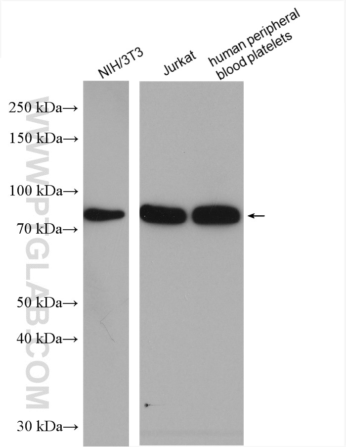 Western Blot (WB) analysis of various lysates using PKC Alpha Polyclonal antibody (21991-1-AP)