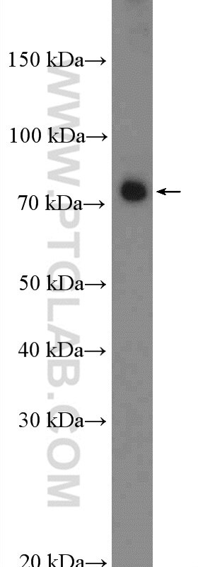 Western Blot (WB) analysis of HEK-293 cells using PKC Alpha Polyclonal antibody (21991-1-AP)