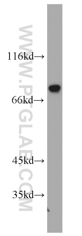 Western Blot (WB) analysis of Jurkat cells using PKC Alpha Polyclonal antibody (21991-1-AP)