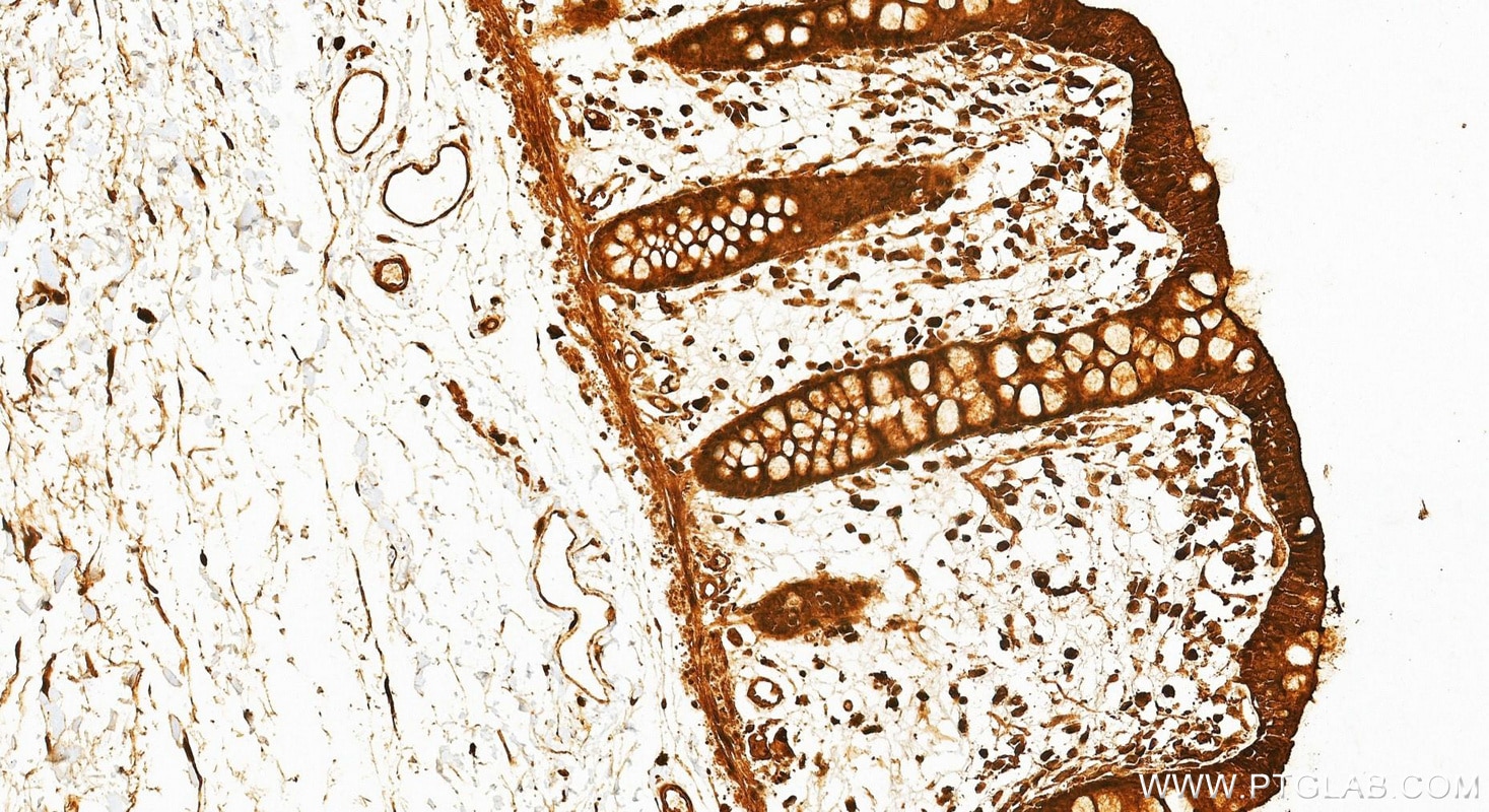 Immunohistochemistry (IHC) staining of human colon tissue using pan-PKC Polyclonal antibody (12919-1-AP)