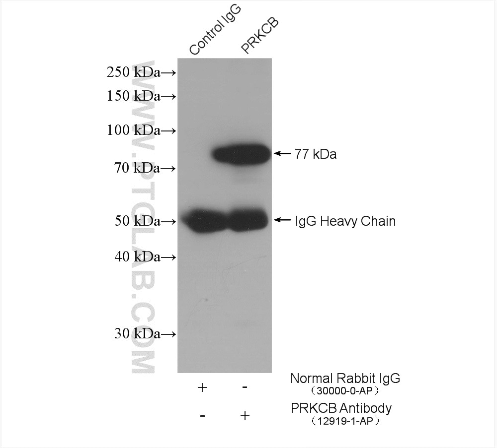 Immunoprecipitation (IP) experiment of mouse brain tissue using PKC Beta Polyclonal antibody (12919-1-AP)