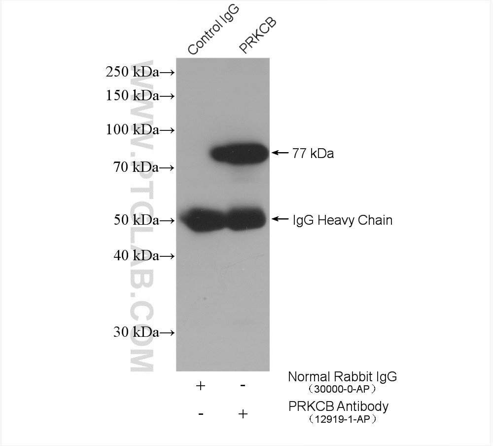 Immunoprecipitation (IP) experiment of mouse brain tissue using pan-PKC Polyclonal antibody (12919-1-AP)