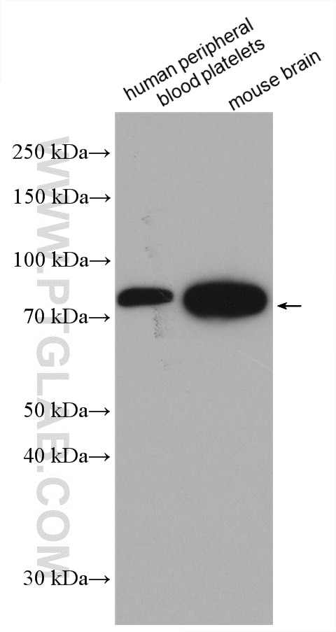 Western Blot (WB) analysis of various lysates using pan-PKC Polyclonal antibody (12919-1-AP)