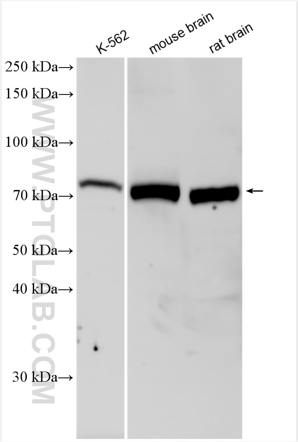 Western Blot (WB) analysis of various lysates using PKC Beta Polyclonal antibody (12919-1-AP)
