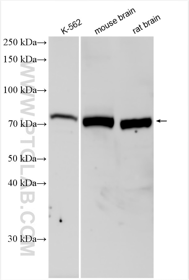 Western Blot (WB) analysis of various lysates using pan-PKC Polyclonal antibody (12919-1-AP)