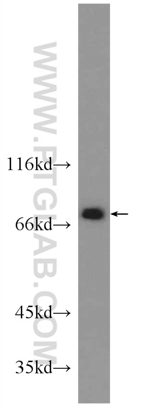 Western Blot (WB) analysis of mouse thymus tissue using pan-PKC Polyclonal antibody (12919-1-AP)