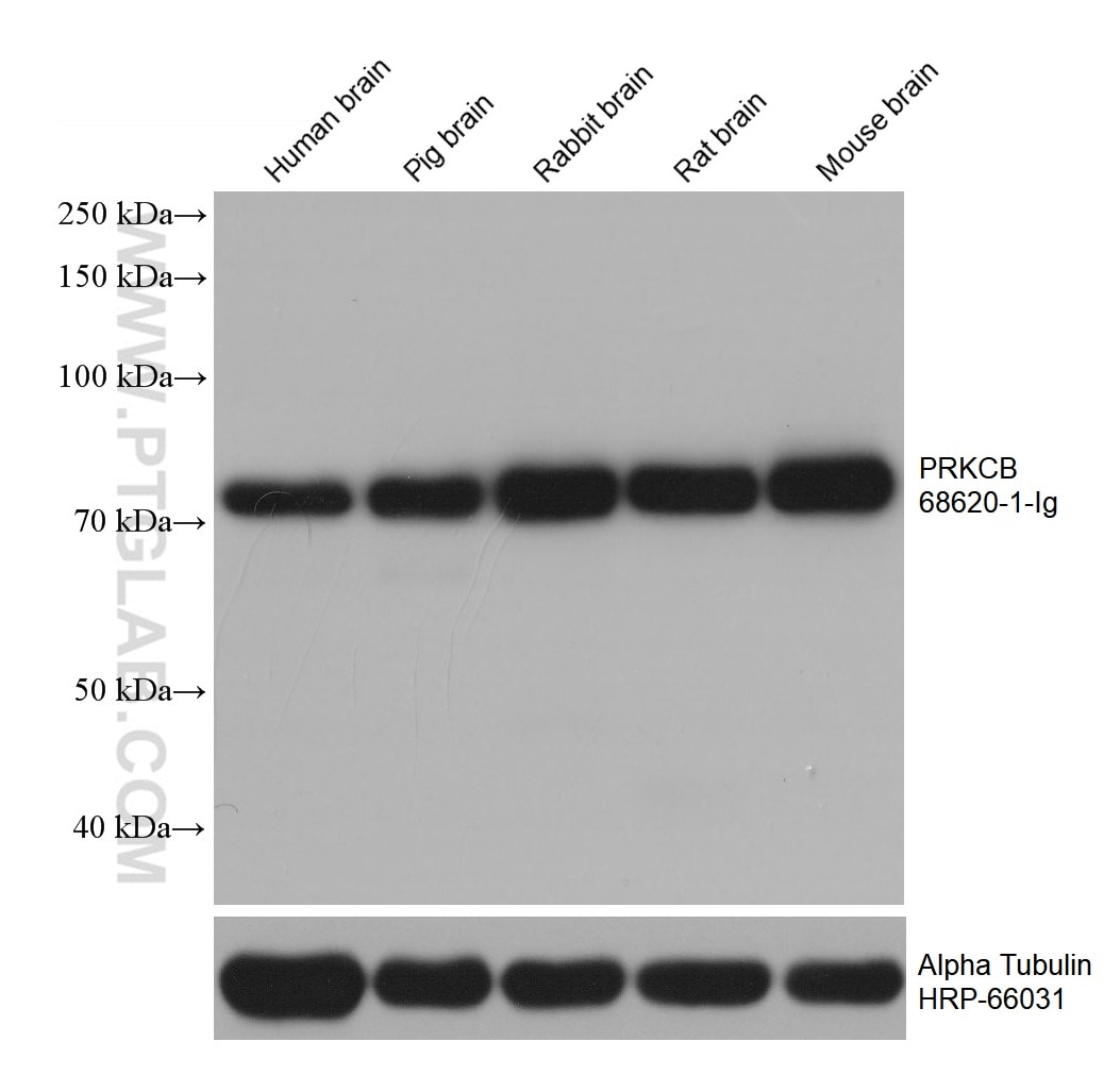 Western Blot (WB) analysis of various lysates using PRKCB Monoclonal antibody (68620-1-Ig)