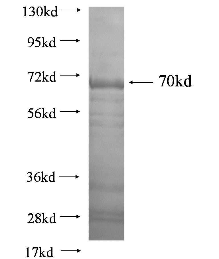 PRKCB fusion protein Ag0918 SDS-PAGE