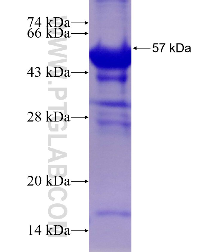 PRKCB fusion protein Ag3591 SDS-PAGE