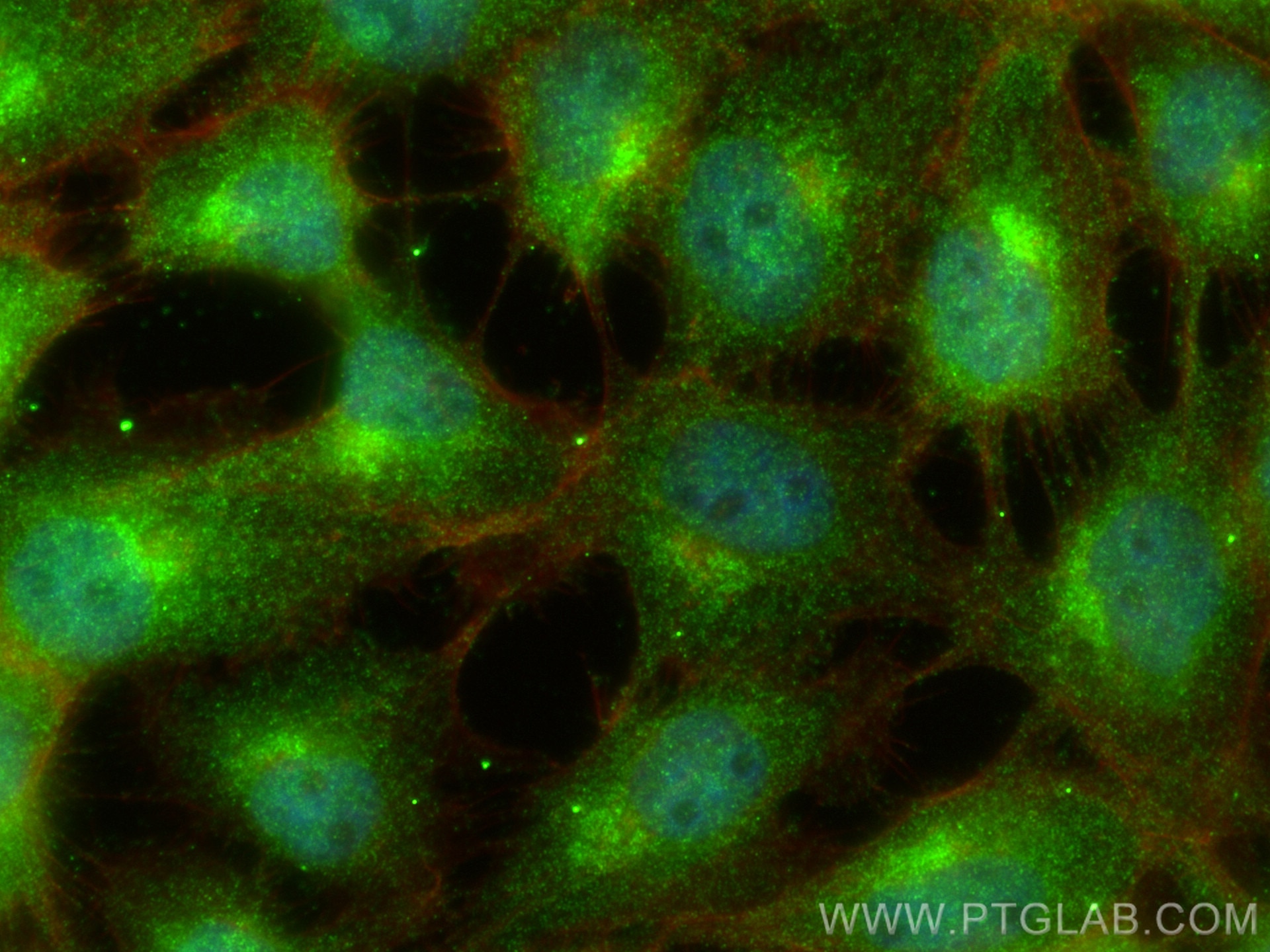 Immunofluorescence (IF) / fluorescent staining of A431 cells using PKC Delta Polyclonal antibody (14188-1-AP)