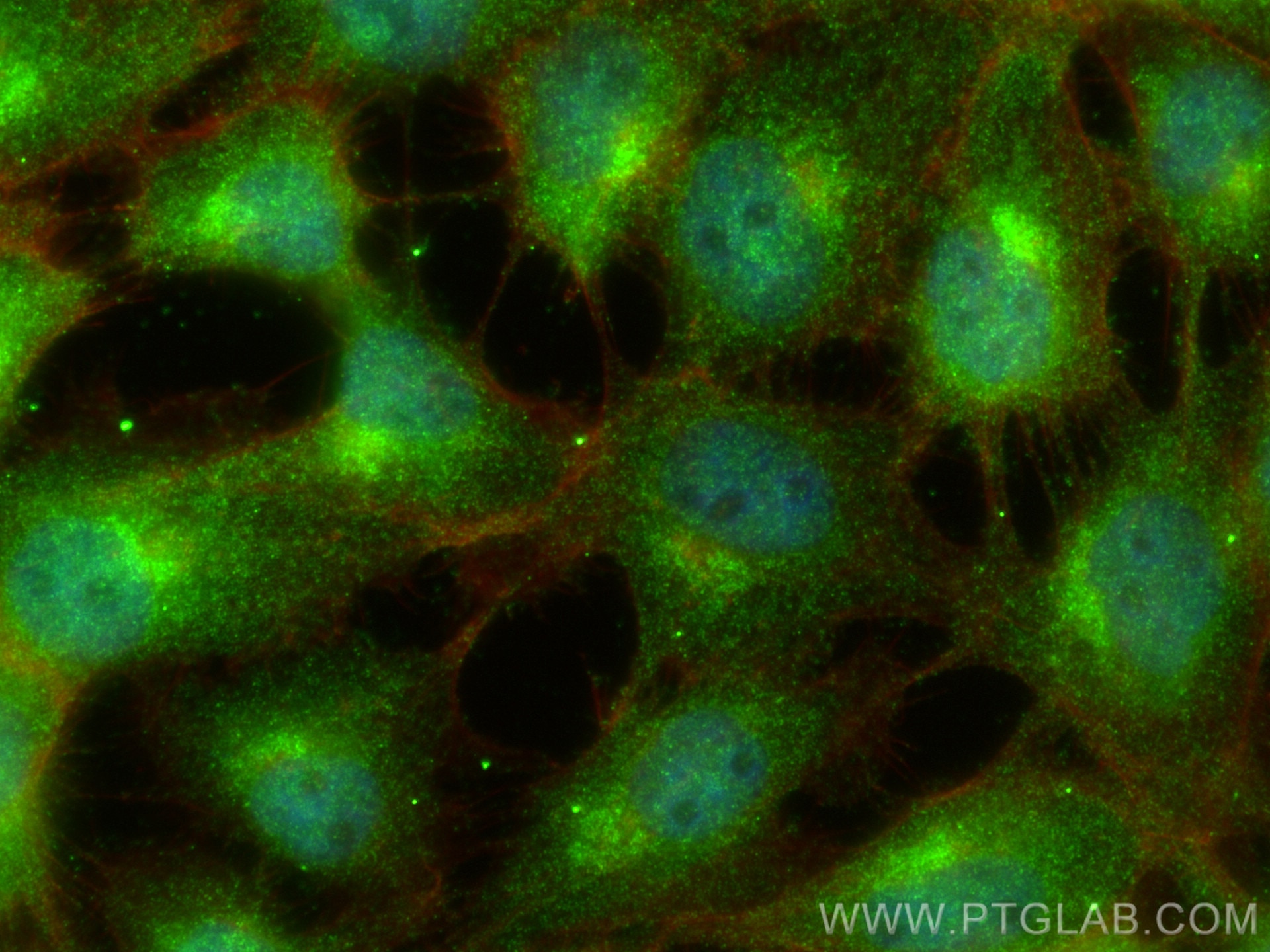 IF Staining of A431 using 14188-1-AP