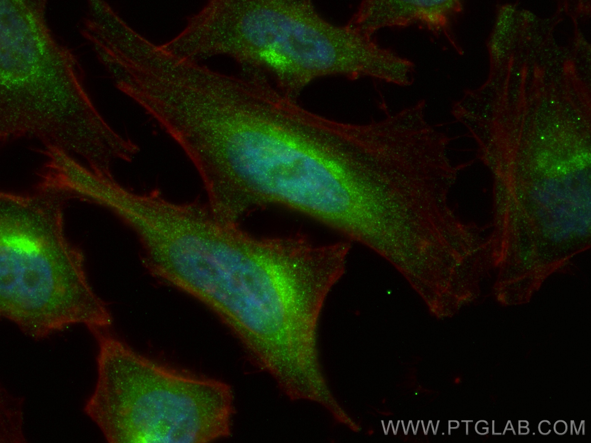 Immunofluorescence (IF) / fluorescent staining of HeLa cells using PKC Delta Polyclonal antibody (14188-1-AP)