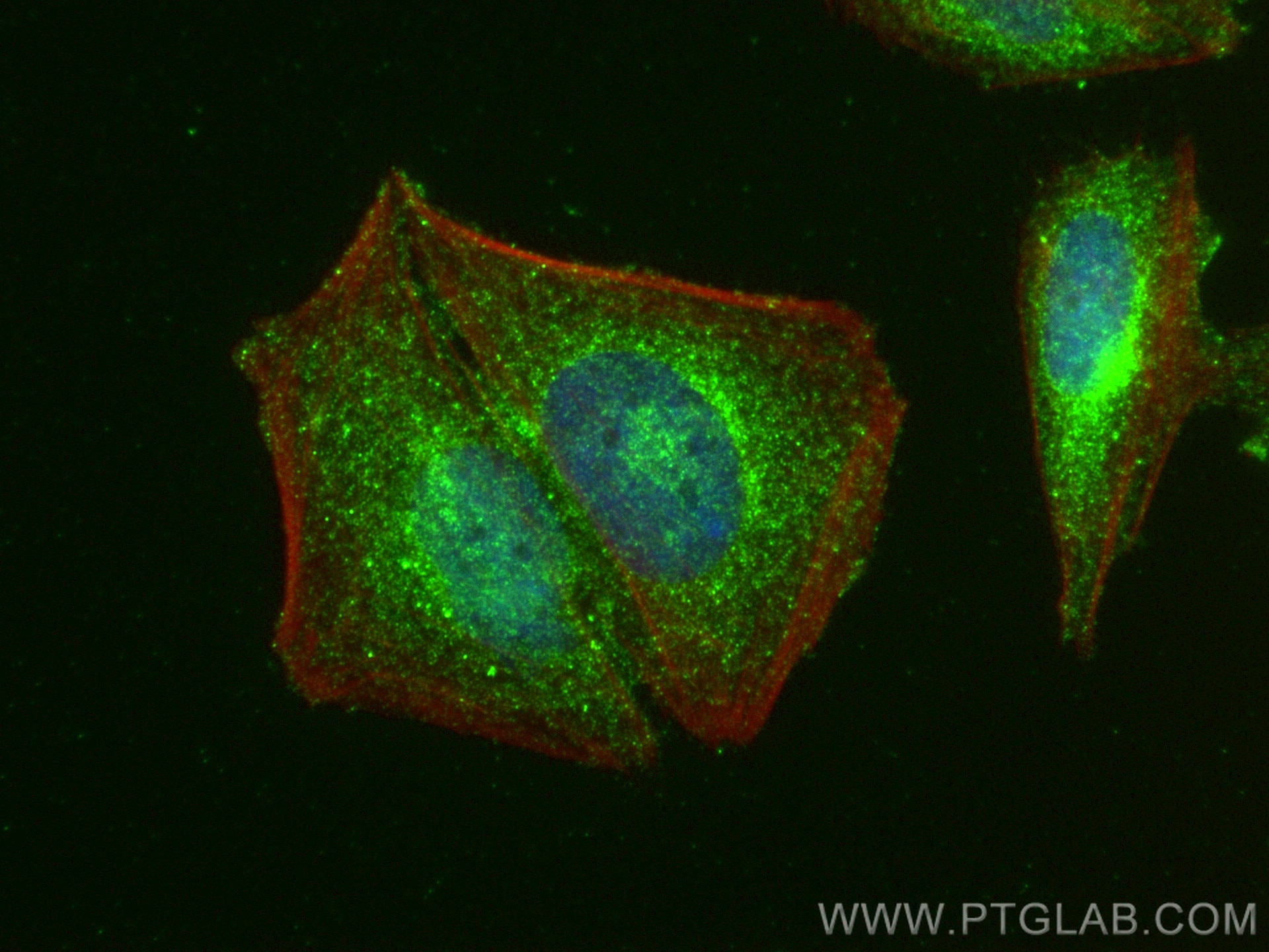 Immunofluorescence (IF) / fluorescent staining of Saos-2 cells using PKC Delta Polyclonal antibody (14188-1-AP)